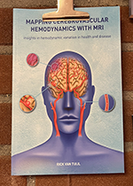 Mapping cerebrovascular hemodynamics with MRI: insights in hemodynamic variation in health and disease ISBN: 9789464731880 - Title: Mapping cerebrovascular hemodynamics with MRI: insights in hemodynamic variation in health and disease